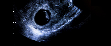 embryonenentwicklung-nach-dem-ivf-verfahren